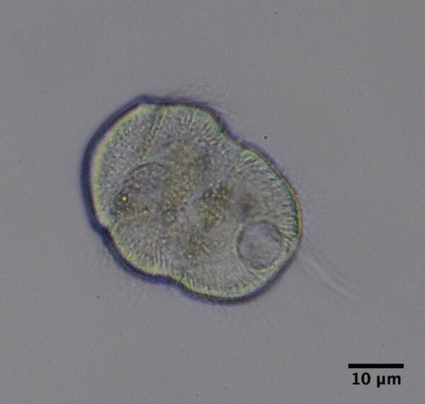 The protozoa is round and the nucleus can be seen near one side of the organism.