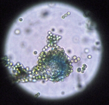 image of Aspergillus flavus under a microscope
